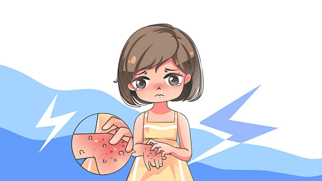 女孩抓挠手臂上长出的疙瘩卡通医疗疾病插画-花瓣网