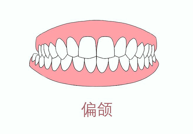 牙齿 口腔 漫画 插画 卡通 牙齿矫正 ...