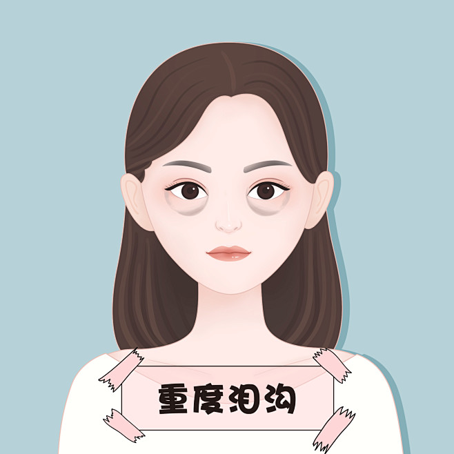 重度泪沟医美整形插画 卡通手绘漫画 可爱...