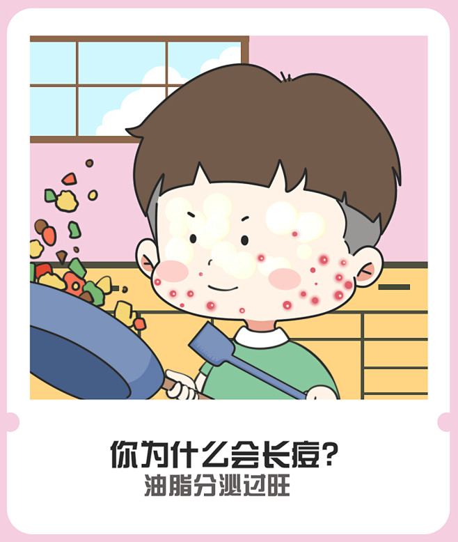 痘痘 长痘 祛痘 无痘美肌 小气泡 果酸...