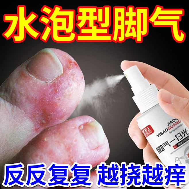 脚气止痒脱皮杀菌脚痒水泡烂脚丫真菌去足癣脚癣一次净喷剂根YR_淘宝搜索图片_1图片素材-花瓣网