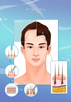 医疗美容院整形瘦身双眼皮隆鼻丰胸手绘插画海报挂画psd设计素材-淘宝网
