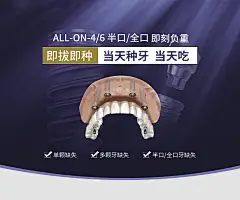 种植广告