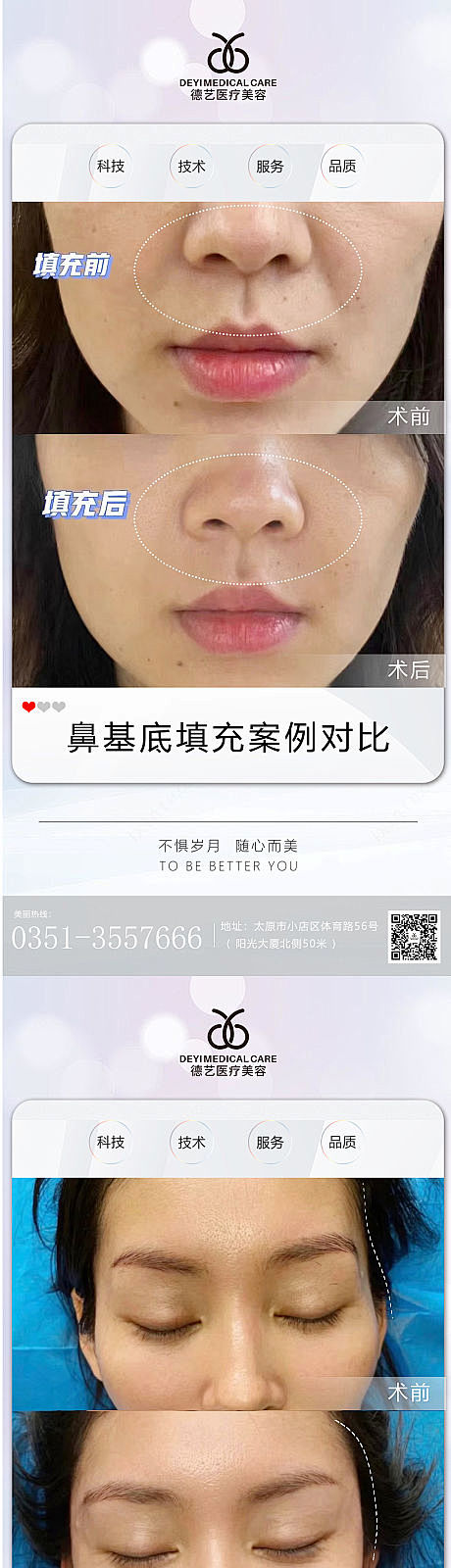 医美案例对比图