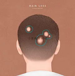 手绘脱发谢顶斑秃头发护理按摩生发插画海报PSD设计素材psd344-淘宝网