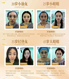 设计师张图图采集到案例