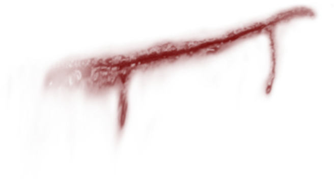 伤疤
采集关注，注明白葵呐