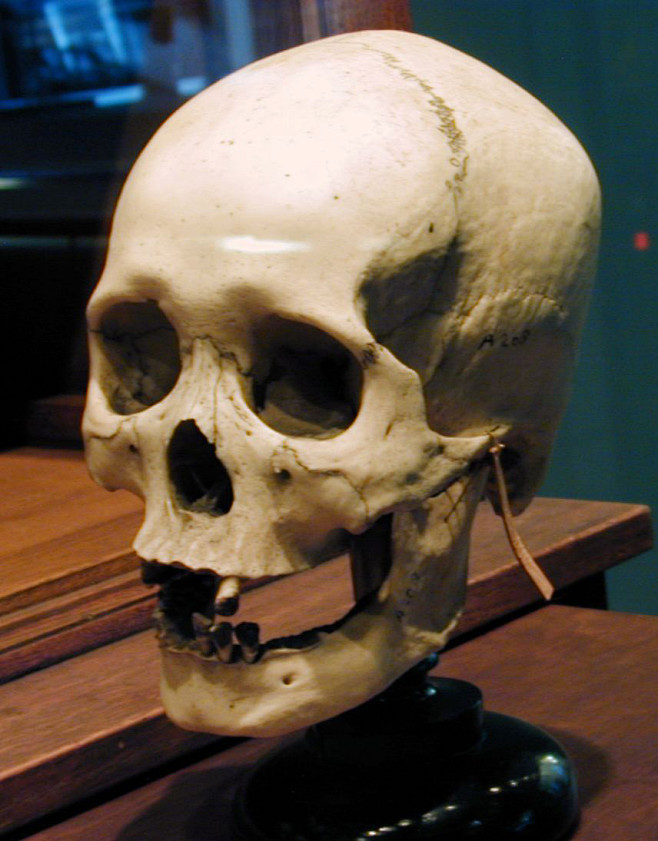 b1skull001 copy
