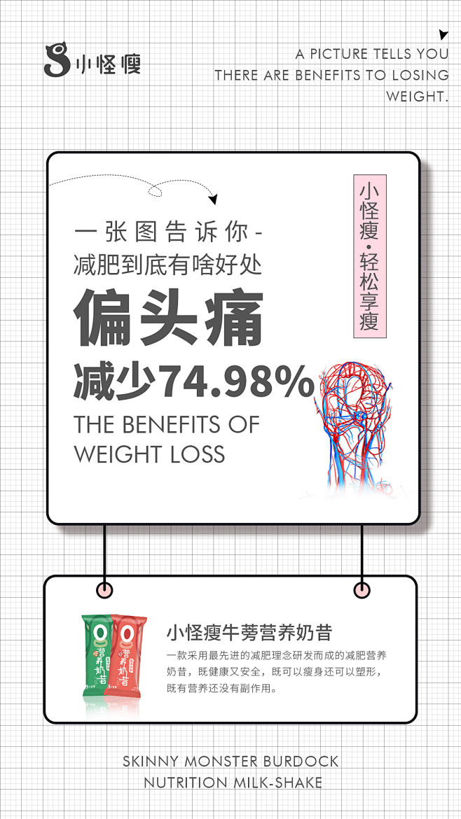 偏头痛