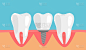 人类牙齿和种植牙平面设计矢量插图。