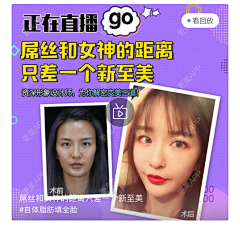 ·旧时、、采集到新氧