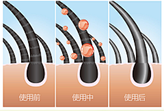 黄黄先生采集到头发组织