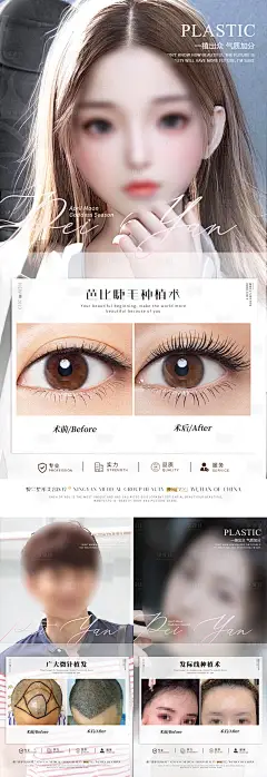 植发案例海报-设计素材-shejisc.cn