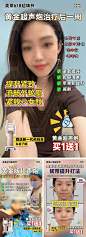 医美网感小红书风格案例海报-源文件