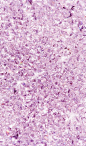 img-1605481948351abdc5f952824518d1745235d11bb2b22