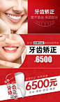 牙齿矫正入口banner图-源文件