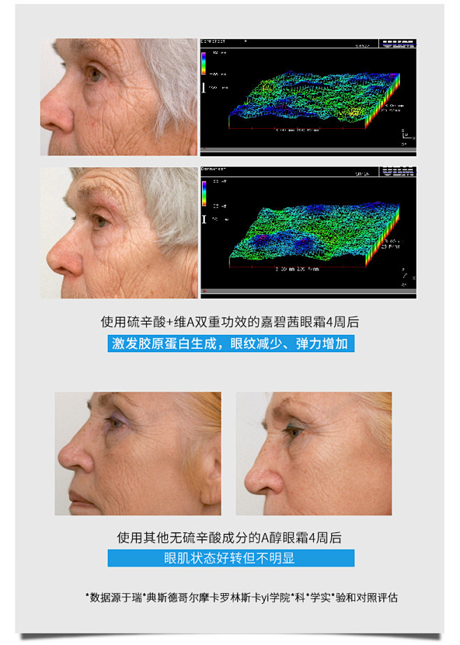 北欧小熨斗 瑞典Jabushe嘉碧茜眼霜...