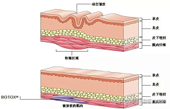 Pakho1984采集到案例