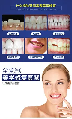 谐禾齿科 二氧化锆全瓷牙冠 真牙质感 钻石硬度 恢复牙齿美观-tmall.com天猫