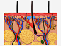 毛囊堵塞_新图网 https://www.ixintu.com 表皮组织 毛发 纤维 细胞组织图 解剖图 表皮结构 肌肤组织