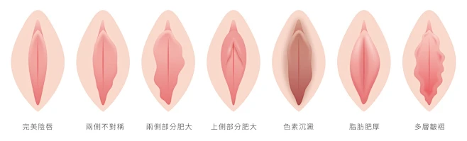 FemTouchGeneoLegendLightsheerAcupulseSmoothGlo: 【私密處陰部構造】完美的陰部長怎樣 ...