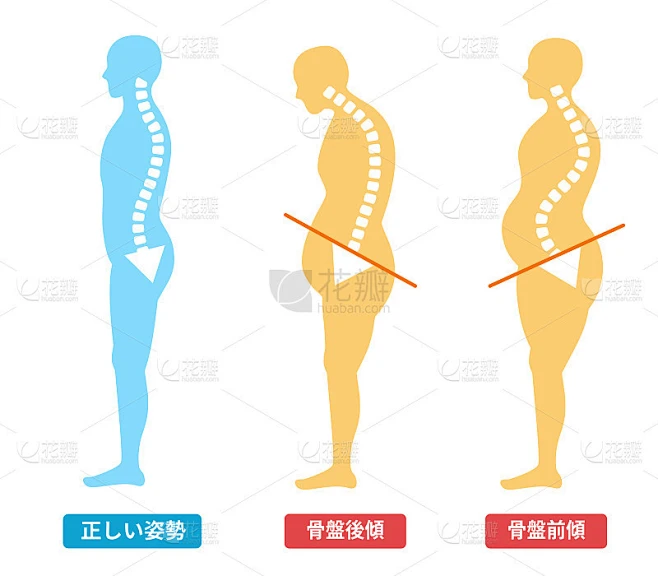 骨盆前后倾斜:正确的姿势和身体插图素材-花瓣网