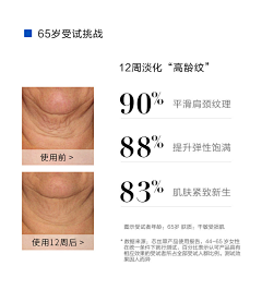 suyangxin采集到Q&A