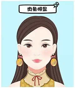 双眼皮失败案例 ​​​​