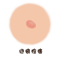 医美君采集到素材【手绘漫画】