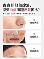 AIREE安伊妮青少年净痘乳控油修护舒缓祛痘快速消红肿痘印小白管-tmall.com天猫