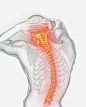 骨骼图宝宝 https://bao16.com 脊椎 颈椎 骨头 疼痛 光效 黄色