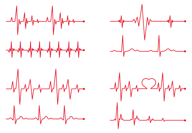 心电图 心跳 PNG素材