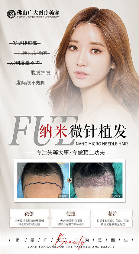 医美植发案例海报-源文件