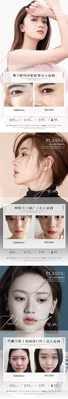 【仙图网】海报 长图 医美 整形  案例 对比  人物  美眼  除皱 瘦脸针 线雕 小V脸|950208 