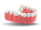 Dental_Implant_2.png (1920×1375)