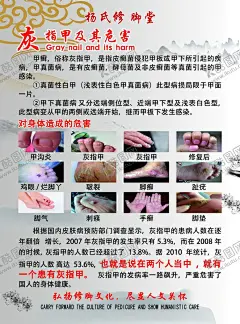灰指甲及危害 【酷图网】灰指甲及危害,灰指甲修复,灰指甲海报,灰指甲,甲沟炎,鸡眼,烂脚丫,皲裂,脚癣,趾疣,脚气,刺瘊,手癣,脚垫,修脚海报