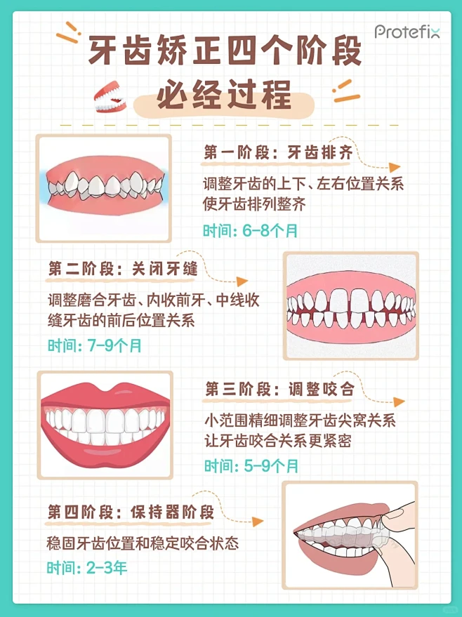 正畸科普｜牙齿矫正必经的四个阶段-花瓣网