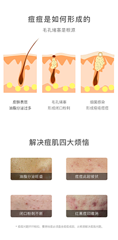 花瓣用户0号采集到MZ-（肌理层/肌肤）