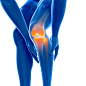 人体三维 3D 各种痛 透视骨骼  膝盖痛腿痛