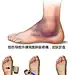 自从请教了康复老师，半年没歪了~~