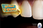 Cepacol牙线广告：牙齿间最微小的东西都是那么闪耀吸引注意力