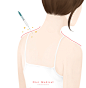 肩部治疗 针头示范 健康瘦身 吸脂整形插图插画设计PSD tid273t000519