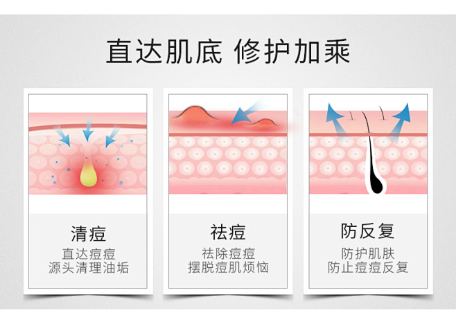 百植萃复合清痘凝胶祛痘舒缓净痘啫喱修护痘...