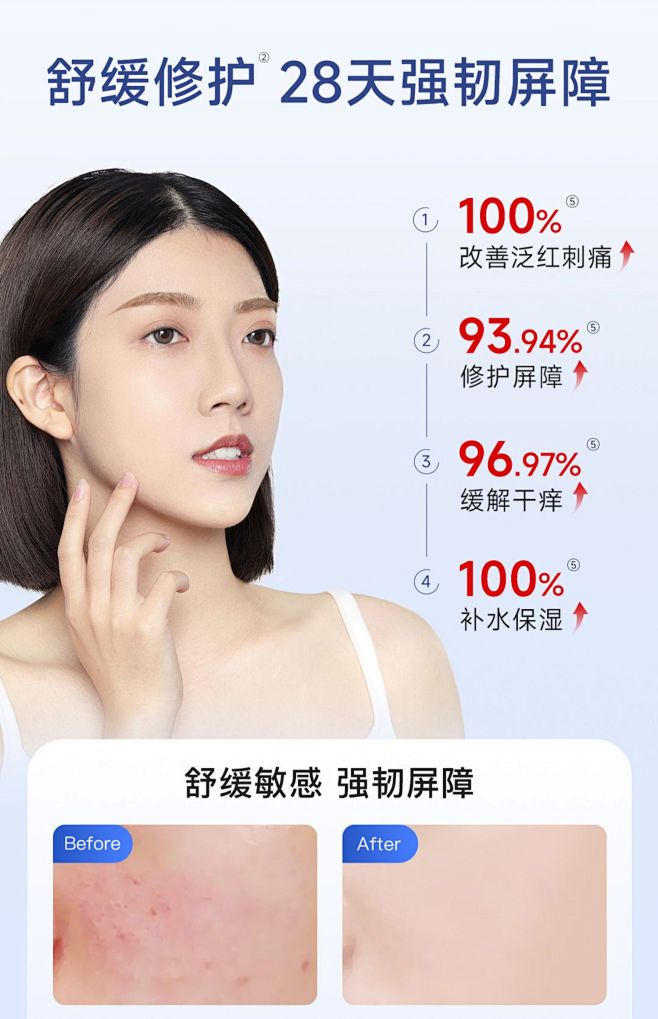 优理氏酵母修护水乳套装舒缓敏感修复屏障补...
