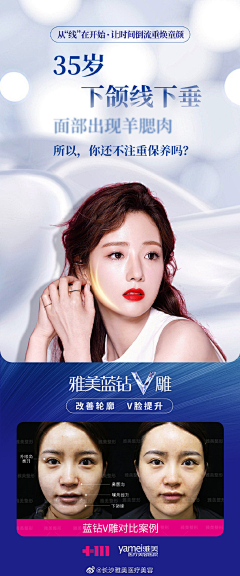 MooSUk3e采集到线雕