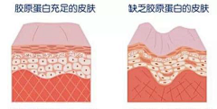 万能老干部采集到肌肤状态