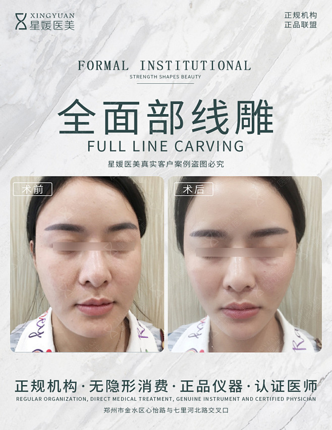 医美效果图对比图前后术后案例效果整形微整医疗美容