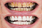 Veer图库-正版商业牙齿图片素材网_免费高清牙齿图片素材下载