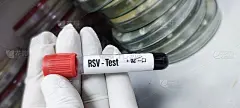 用于呼吸道合胞病毒(RSV)检测的血液样本，这是一种常见的呼吸道病毒，通常会引起轻微的感冒症状