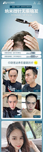 【源文件下载】 海报 长图 医美 整形 植发 宣传 案列 246549